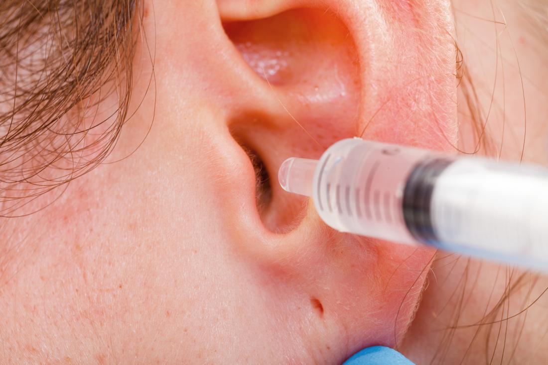 Where To Buy Quality Hydrogen Peroxide Products?